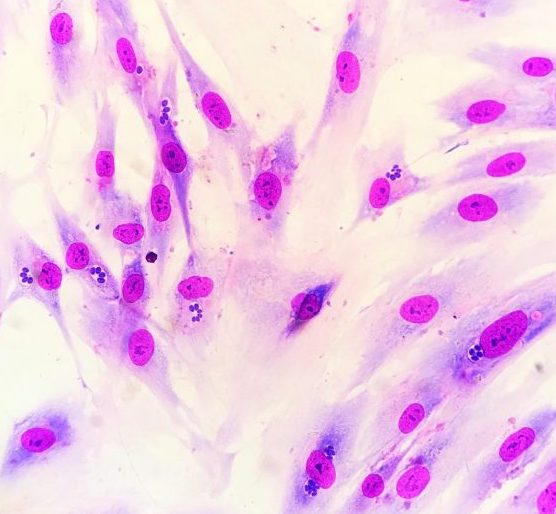 Toxoplasma gondii under a microscope